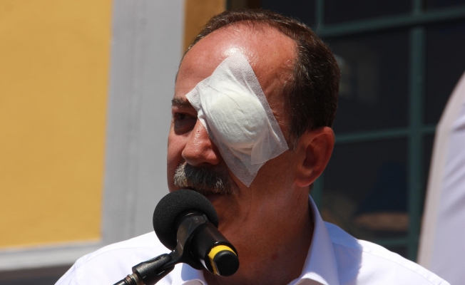 CHP'li belediye başkanına yumurtalı saldırı
